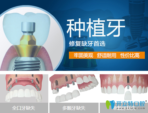 牙齒缺失說(shuō)話(huà)漏風(fēng)？德陽(yáng)新橋口腔種植牙幫你改善缺牙問(wèn)題