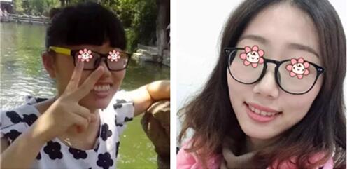 事實(shí)證明沈陽愛齒口腔張小龍給我做的齙牙矯正效果蠻好！