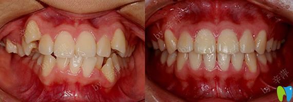 深圳愛康健口腔怎么樣？看愛康健牙齒正畸