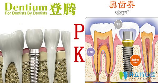 韓國登騰和奧齒泰哪個更好？兩個種植體優(yōu)劣對比(2024新版)