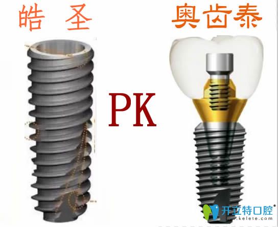 美國皓圣和韓國奧齒泰哪個(gè)種植體好？價(jià)格及使用壽命大PK