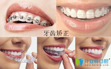 周佩佩科普：“牙齒矯正的年齡是什么時(shí)候？”