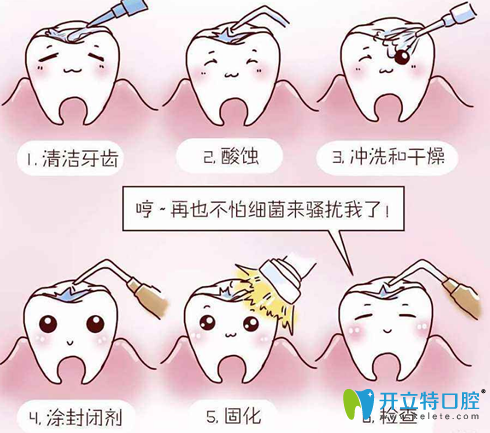 深度揭秘：窩溝封閉是個(gè)騙局?窩溝封閉后更容易爛牙？