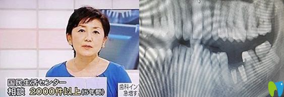 2012年1月日本電視臺種植牙事故報道