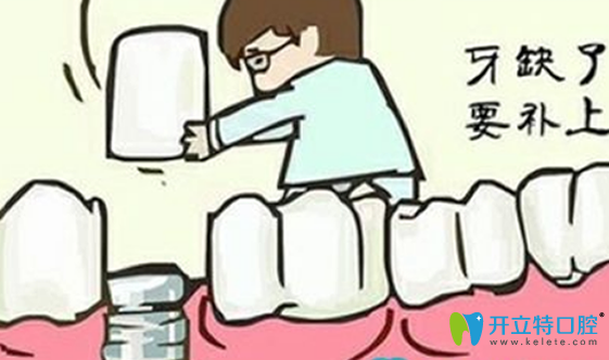 拔牙后多久可以鑲牙？拔牙后鑲牙有沒有時(shí)間