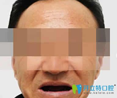 無錫通善口腔怎么樣
