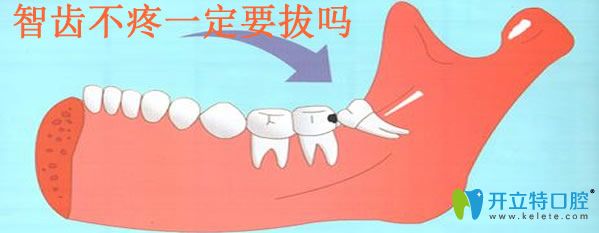 全面了解拔智齒的危害并分享智齒不疼一定要拔嗎？