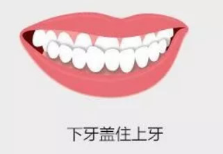 我孩子6歲牙齒是地包天 矯正價(jià)格要多少錢(qián)/年齡是幾歲