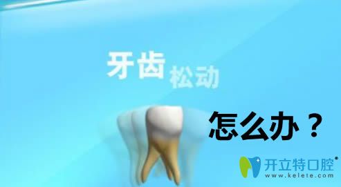 牙齒松動怎么治療？做修復(fù)的話價格大概需要多少錢？