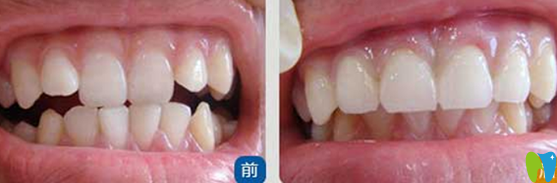 天津美萊口腔高志永怎么樣？真人案例及反饋來嘍