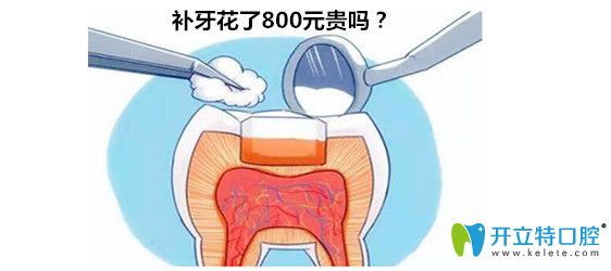 <!--<i data=20240703-sp></i>-->補(bǔ)牙800元貴不貴