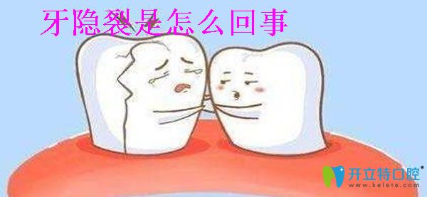 牙隱裂治療多少錢 有沒(méi)有想過(guò)牙齒裂縫怎么回事能撐幾年