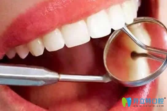 洗牙對(duì)牙齒好嗎？這里告訴你洗牙對(duì)牙齒有沒(méi)有傷害