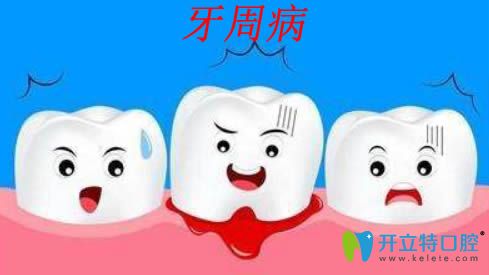 牙周病是什么？治療牙周病的方法和臨床效果分析