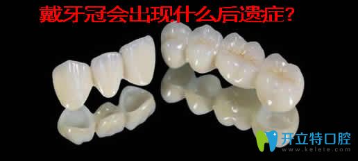 戴牙冠會出現(xiàn)什么后遺癥？介紹牙冠的種類及價格