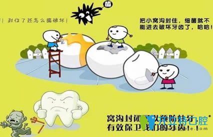 開(kāi)立特口腔網(wǎng)兒童窩溝封閉的好處及時(shí)間
