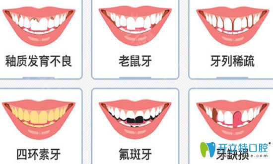 前牙美學修復過程及適應癥