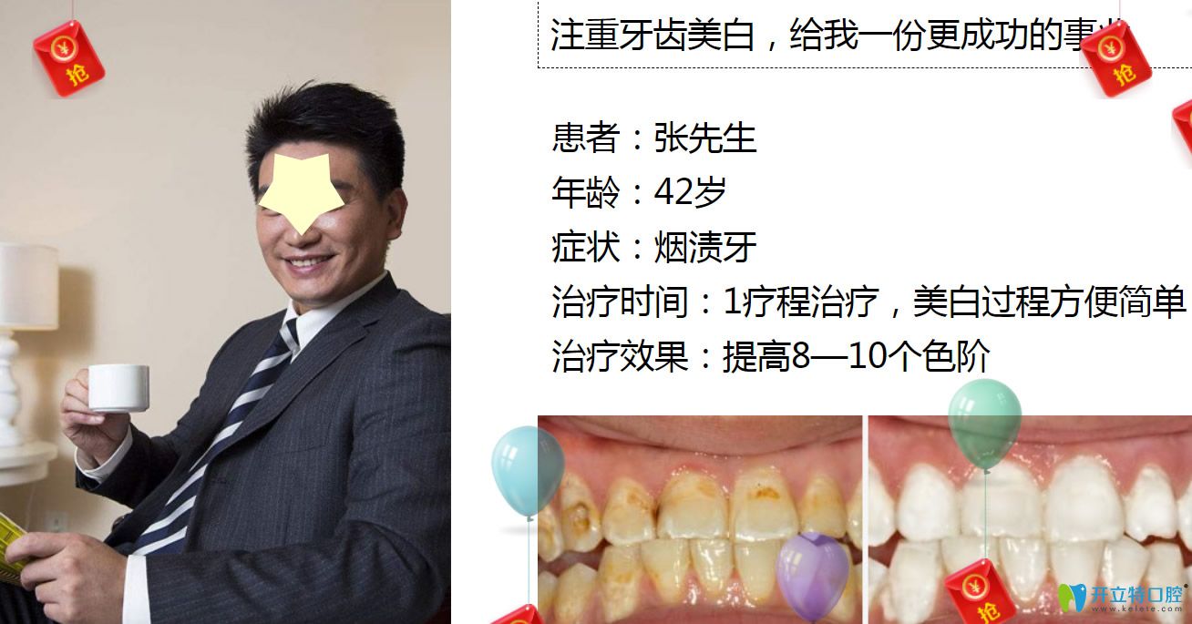 深圳牙齒美白哪里做？格倫菲爾口腔皓齒美白案例公布