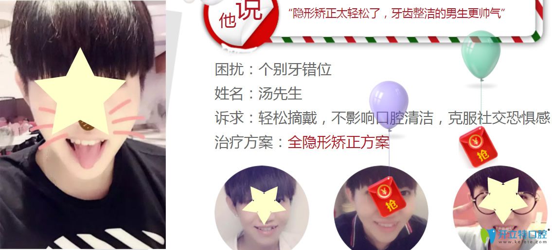 深圳格倫菲爾口腔水平怎么樣？看牙齒正畸真人案例反饋