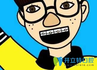 國(guó)外正畸不拔牙的真實(shí)原因