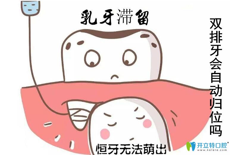 兒童出現(xiàn)了雙排牙怎么辦，會不會自從歸位