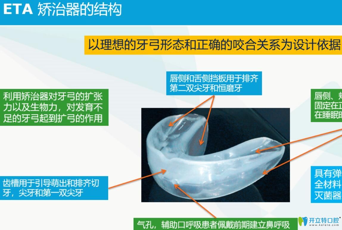 醫(yī)生揭秘：ETA早期矯治技術是什么？ETA兒童早期矯治好嗎？