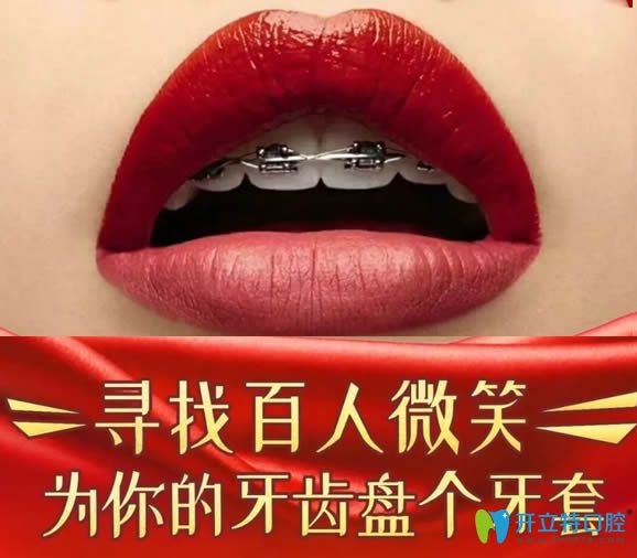 鄭州拜博口腔尋找百人微笑為您的牙齒盤個牙套