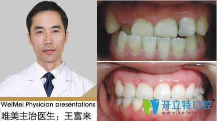 <!--<i data=20240703-sp></i>-->正畸醫(yī)生王富來和案例效果對(duì)比圖