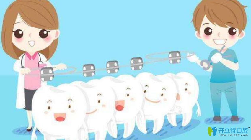 矯牙為什么那么貴？資深牙醫(yī)告訴你不知道的正牙價格內幕