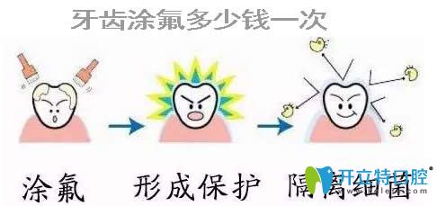 小孩牙齒涂氟多少錢