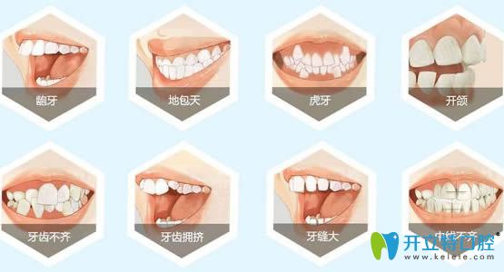 不同的牙齒癥狀矯治時(shí)間和方法也不同