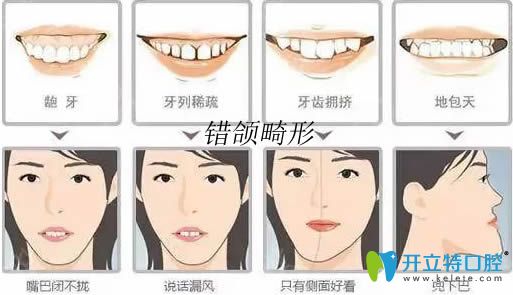 了解牙頜畸形的危害后你更想知道錯頜畸形的矯治方法