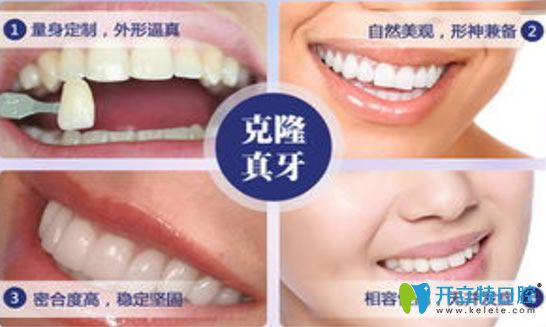 美容冠牙齒優(yōu)點(diǎn)