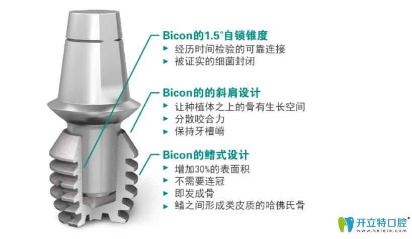 扒一扒種植牙領(lǐng)域種植體品牌的前世今生