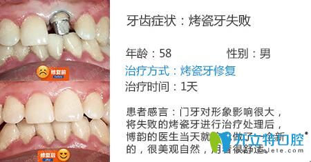 醫(yī)生姓名：周光正   醫(yī)生資質(zhì)：全科醫(yī)生  所屬機(jī)構(gòu)：南京博韻口腔  社會任職：  畢業(yè)院校：畢業(yè)于邢臺<!--<i data=20240703-sp></i>-->口腔醫(yī)學(xué)系  主診項(xiàng)目：牙列缺損修復(fù)、口腔種植、前牙美學(xué)修復(fù)、嵌體修復(fù)及復(fù)雜牙拔除。