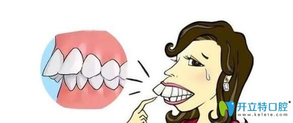 做過掩飾性正畸可以正頜嗎？真人經(jīng)驗分享