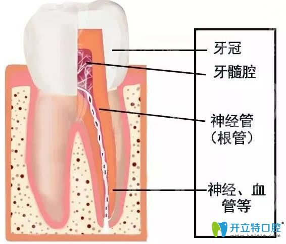 牙神經(jīng)壞死怎么治療及治療價(jià)格，你知多少？