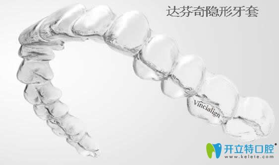 知否:國產(chǎn)達芬奇隱形牙套多少錢及矯正效果怎么樣