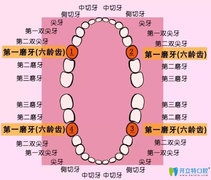 如果沒有問題牙，通常會對稱拔除一顆前磨牙（雙尖牙）