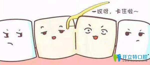 口腔內的單冠和連冠的利弊