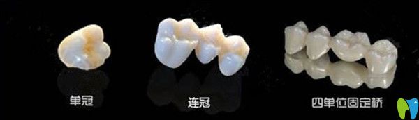 當牙齒缺損時，選擇單冠好還是連冠好？