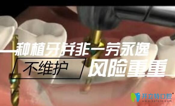 梅州中大口腔醫(yī)生介紹種植牙術(shù)后護理方法