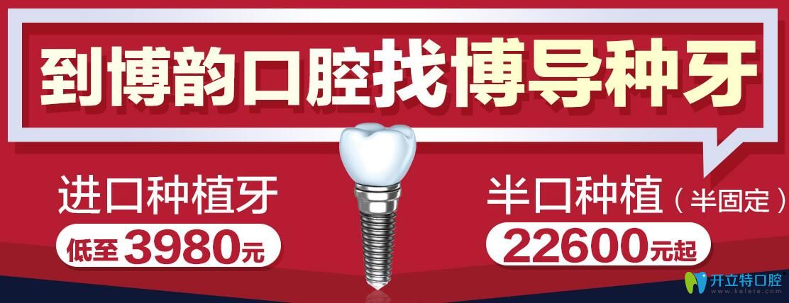 南京博韻口腔找博導(dǎo)種牙，半口種植（半固定）才49800元起