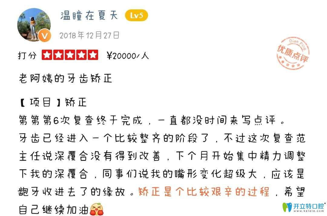 顧客正在成都圣貝口腔正畸中，表示變化挺大的