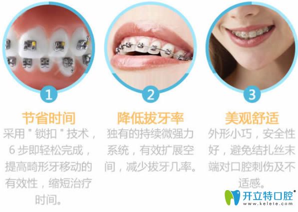 選擇青島諾德齒科黃主任做牙齒矯正的技術優(yōu)勢