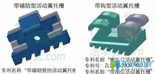 活動(dòng)翼矯治器兩種類(lèi)型