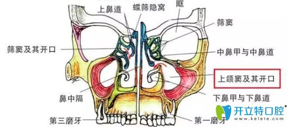 弄清了上頜竇內(nèi)外提升術(shù),你就知道種牙時上頜竇提升危險不
