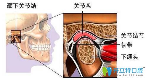 顳下頜關(guān)節(jié)紊亂能整牙嗎？正畸會不會導(dǎo)致顳頜關(guān)節(jié)紊亂？