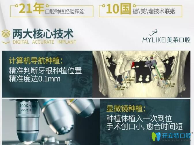 深圳美萊口腔3D顯微精準種植技術
