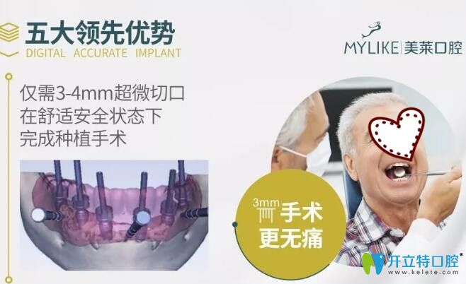 深圳美萊口腔3D顯微精準種植牙5大優(yōu)勢
